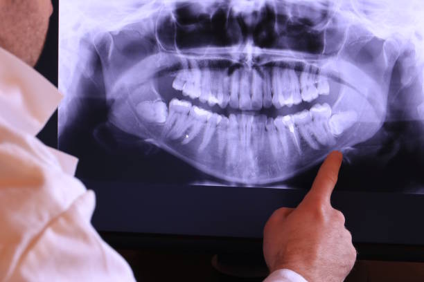 Best Emergency Treatment for Toothache in Dawsonville, GA