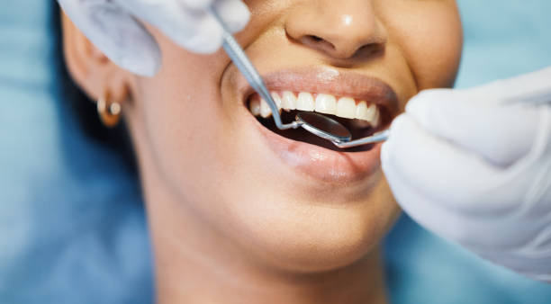 Best Walk-In Emergency Dentist in Dawsonville, GA