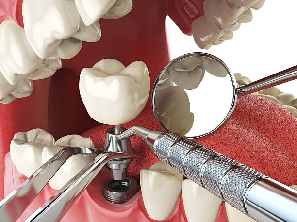 Best Emergency Dental Surgery in Dawsonville, GA